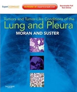 Imagem de TUMORS AND TUMOR-LIKE CONDITIONS