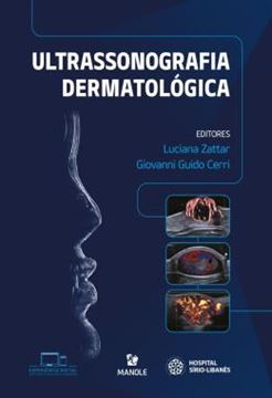 Imagem de ULTRASSONOGRAFIA DERMATOLOGICA