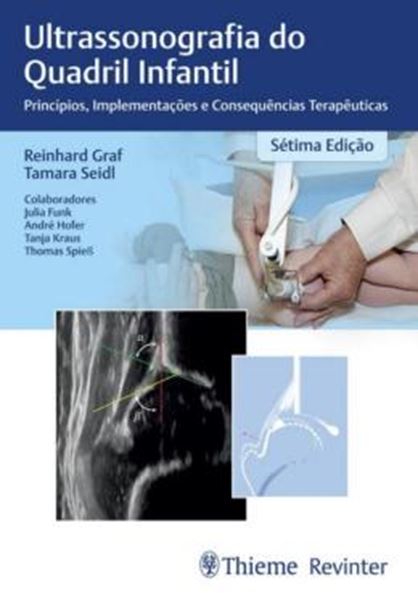 Picture of ULTRASSONOGRAFIA DO QUADRIL INFANTIL - 7ª ED.